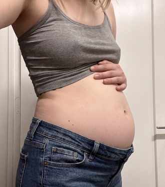 Patient before — bloated abdomen